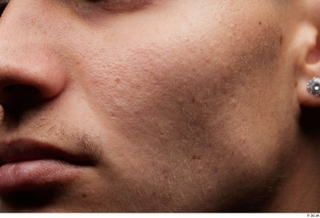 HD Face Skin darren cheek face lips mouth nose skin…